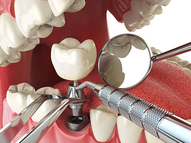 Best Urgent Dental Care in Nappanee, IN
